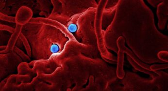 Coronavirus disease (COVID-2019) R&D
